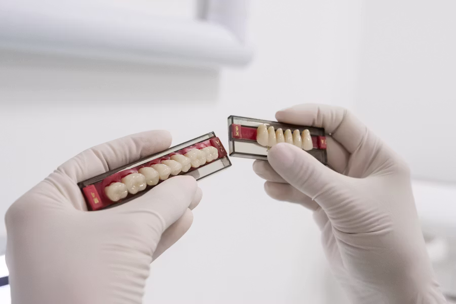 Cura dell'impianto dentale — Studio Dentistico Barbara Vertechy