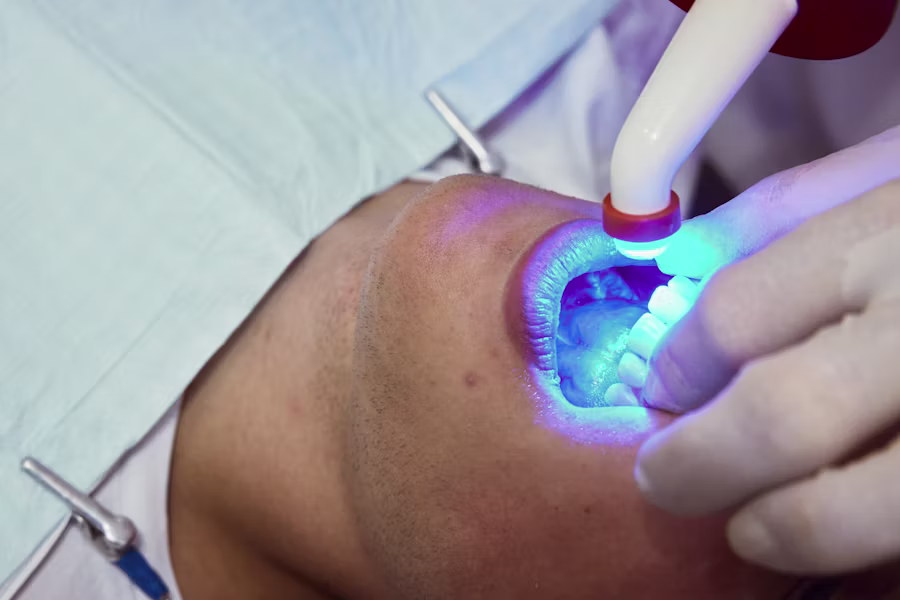 Sbiancamento denti professionale in studio — Studio Dentistico Barbara Vertechy